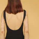 ASL Bari, corso di perfezionamento sul linfedema dell’arto superiore: tre edizioni tra aprile e maggio 2026